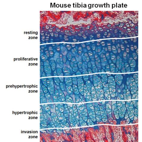 Organization of a 15-day-old murine tibia growth plate. Microphotograph... | Download Scientific ...