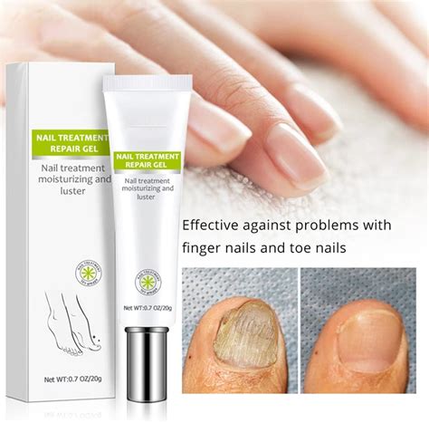 Nail Repair Gel – Munafacart