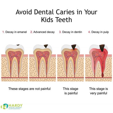 baby bottle tooth decay definition - Melodi Kilpatrick