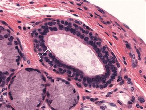 Epithelial cells | Flashcards