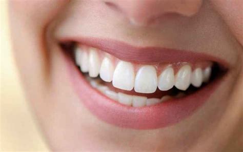 8 dicas infalíveis para um sorriso bonito e harmônico