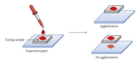 A schematic diagram of the blood agglutination test. | Download Scientific Diagram