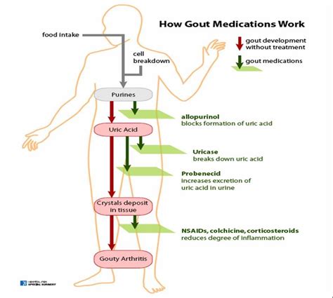 HEALTH FROM TRUSTED SOURCES: Gout