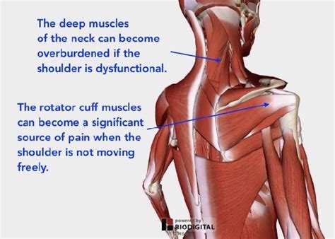 Understanding Shoulder Pain — Neuromuscular Therapy of Vermont