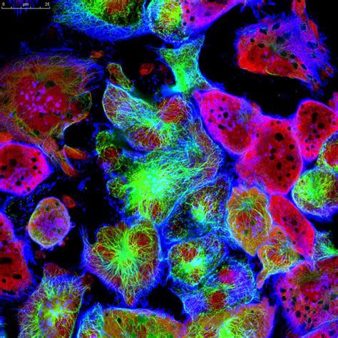 Cell Segmentation and Abnormality Risk Estimation by RSIP Vision