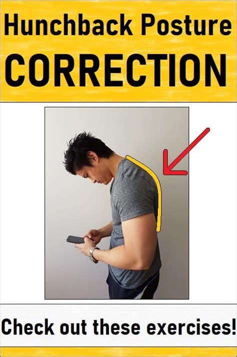 Hunchback Posture Correction | Posture correction, Postures, Forward head posture