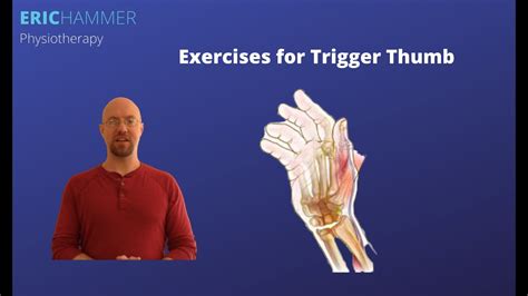 Exercises for Trigger Thumb - YouTube