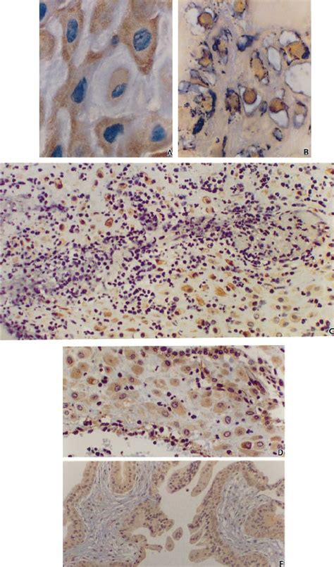 Fas ligand expression in the trophoblasts shown by:... | Download Scientific Diagram