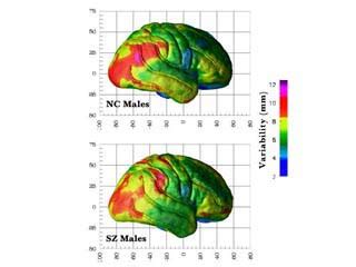 Schizophrenia.com - Schizophrenia is a Brain Disease