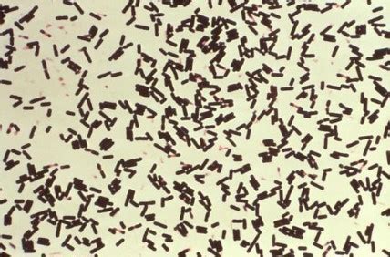 An overview of Clostridium - Creative Diagnostics