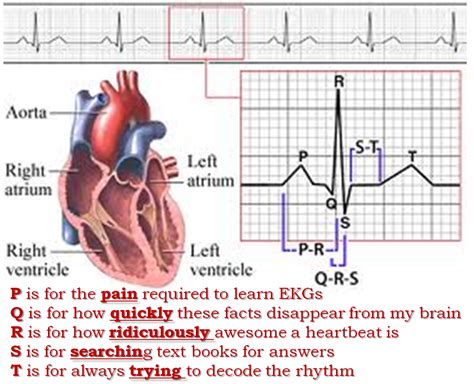 2,012 miles for Life: EKG mnemonic