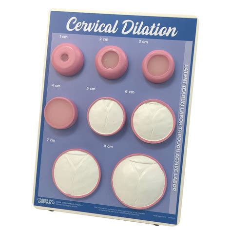 Cervical Dilation Easel Display | Childbirth Graphics