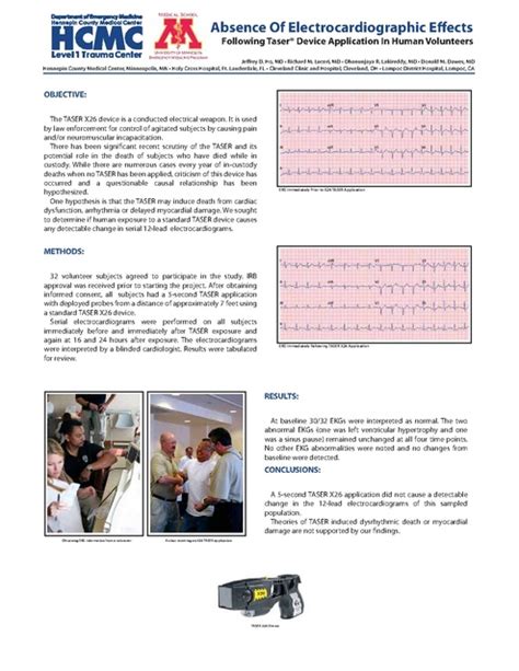 Taser X26 Absence of Electrocardiographic Effects Minnesota | Prison Legal News