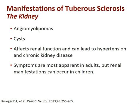 PPT - Tuberous Sclerosis Complex Fundamental Concepts in Diagnosis and Management PowerPoint ...