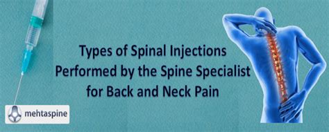 Types of Spinal Injections Performed for Back and Neck Pain Treatments