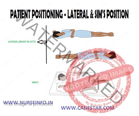 PATIENT POSITIONING – LATERAL & SIM’S POSITION - Nurse Info PATIENT POSITIONING – LATERAL & SIM ...