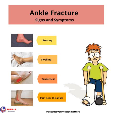 Ankle Fracture: Signs & Symptoms