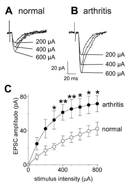 Synaptic transmission in SG neurons is enhanced in the arthritis pain ...