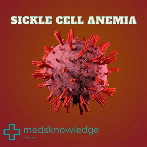 Understanding Sickle Cell Anemia: Causes, Symptoms,Treatments