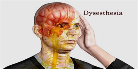 Dysesthesia - Assignment Point