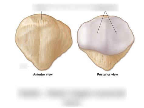 MSK: Patella Bony Landmarks Diagram | Quizlet