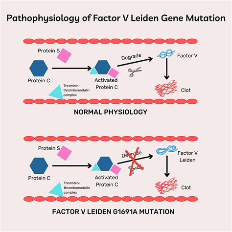 Factor V Leiden Mutation USMLE YouTube