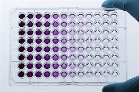 Automated MTT assay for cell proliferation | INTEGRA