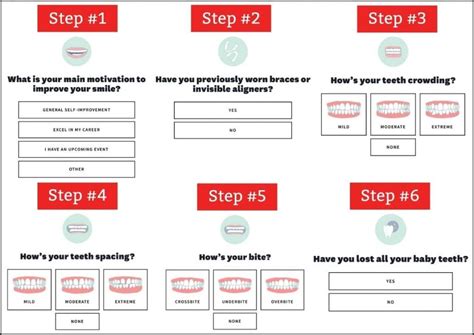 Byte Aligners Review