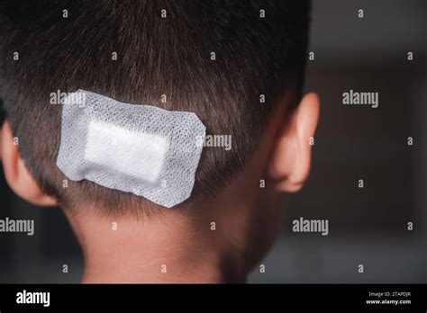 Back of head scar hi-res stock photography and images - Alamy