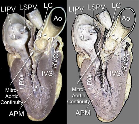 e-heart.org Cardiovascular Pathology Home Page