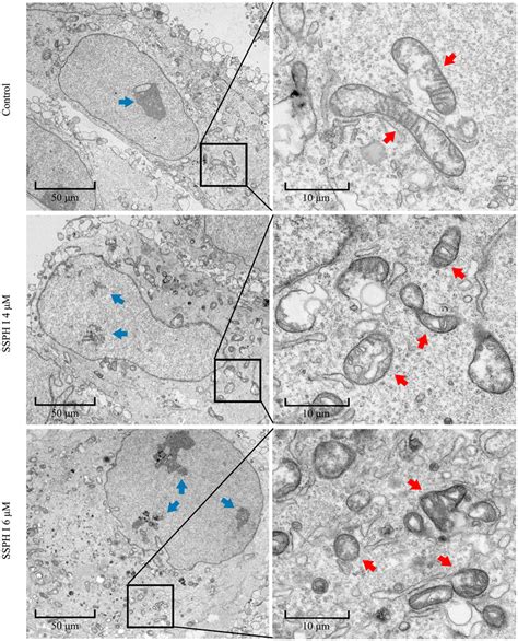 SSPH I induces typical morphologic changes of ferroptosis in HepG2... | Download Scientific Diagram