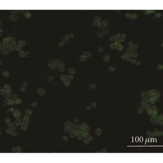 Kupffer cells isolation and identification. Kupffer cells were isolated ...