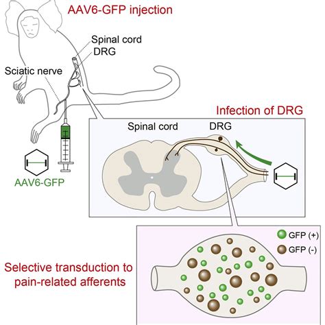 Specific gene expression in unmyelinated dorsal root ganglion neurons ...