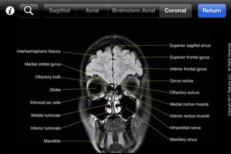 Mobile MRI brain atlas medical app review, NeuroRad Mini