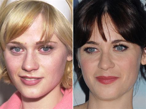 Zooey Deschanel Botox