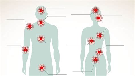 Living with Fibromyalgia – Equality, Diversity and Inclusion