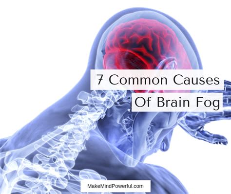 7 Possible Causes Of Brain Fog That Demand Your Attention - Mindfulness ...