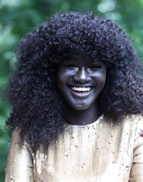 This Girl Was Bullied For Her Skin Color. Now She's A Badass Model ...