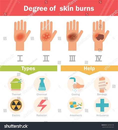 180,300 Burning Hands Images, Stock Photos & Vectors | Shutterstock