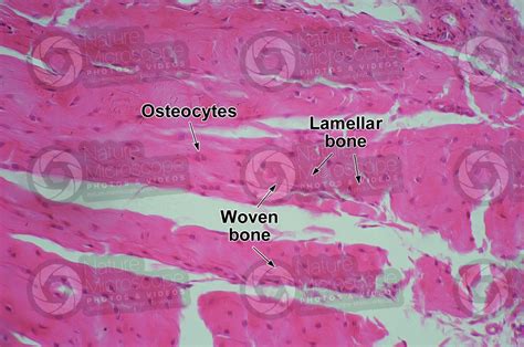 Mammal. Joint. Transverse section. 250X - Woven bone - Bone ...