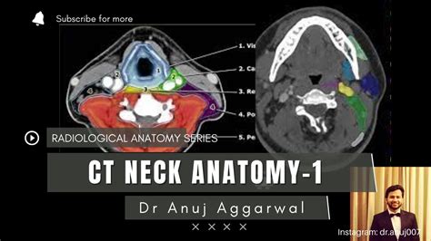 CT Neck Anatomy (Radiology Basics)| Anuj Aggarwal - YouTube