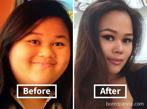 128 Surprising Photos of Face Fat Loss Before and After Weight Loss | Bored Panda