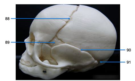 fetal skull sutures and fontanelle (lateral view) Diagram | Quizlet