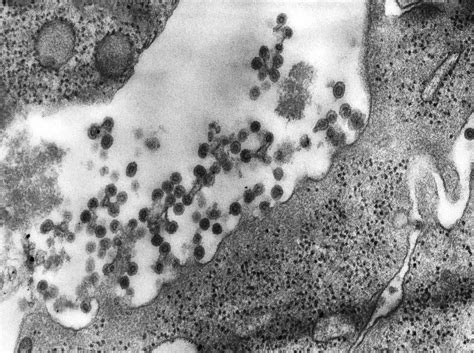 File:Rubella virus 01.jpg - Embryology