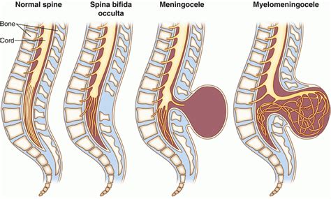 Intraoperative Monitoring for Surgery of the Spinal Cord and Cauda Equina | Neupsy Key