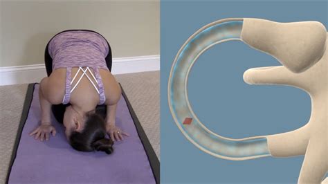 Half Somersault Maneuver to Treat BPPV Vertigo - YouTube