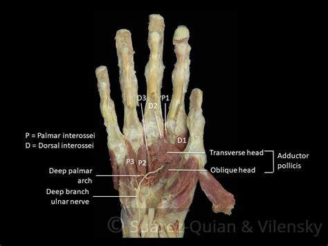 The Muscles of the Hand - Thenar - Hypothenar - TeachMeAnatomy