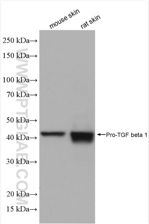 TGF Beta 1 antibody (21898-1-AP) | Proteintech