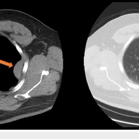 pericardial window | Download Scientific Diagram