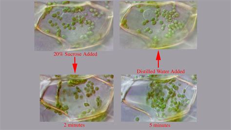 ‎Elodea cell : turgid, plasmolyzed, recovered - UWDC - UW-Madison Libraries